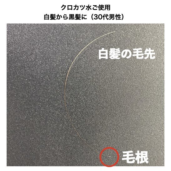 100mlプレゼント クロカツ水 300ml 3 白髪予防 白髪 染めない 白髪改善 ヘアトニック ダークニル 送料無料 白髪を黒髪に戻すローション トニック Rvcconst Com
