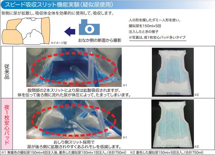 訳あり】 1袋1 420円 アテントSケア夜１枚安心パッド多いタイプ 30枚×3袋 目安吸収量約6回分 夜1枚安心パッド 6回吸収 尿取りパッド 尿とり パッド 尿パッド 尿パット 尿取りパット 尿とりパット 夜用 パッド 大人用紙おむつ 紙おむつ 消臭加工 qdtek.vn