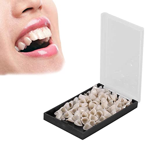Make the Dental mamelon! こだわりの前歯部精密修復 Make the Dental mamelon! こだわりの前歯部精密修復| 歯科総合