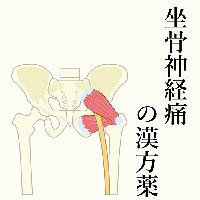 【第2類飲み薬】座骨神経痛の漢方薬 1日2～4回取り入れる 1か月分  漢方薬 座骨神経痛 薬 漢方 神経痛 知覚麻痺 足 お薬 苦痛なこと 足の知覚麻痺 足の知覚麻痺に 麻黄 当帰 ヨクイニン 名取り草 名取り草 肉桂 知覚麻痺 蝶つがい痛 腕力痛 貨物輸送無料  電話を掛ける無料話しあい・電子メイル話しあい24第四次元相応う