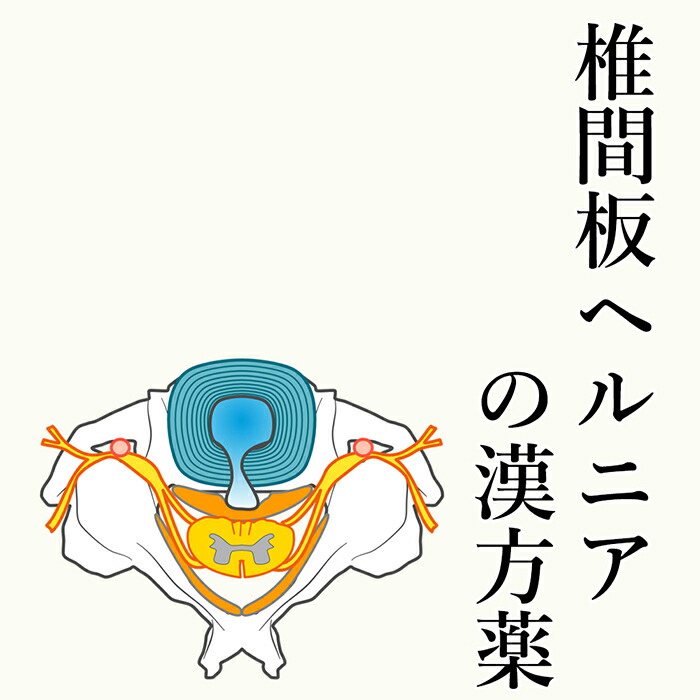 【第2類飲み薬】椎間板脱腸の漢方薬 1日2～4回取り入れる 1か月分 漢方薬 椎間板脱腸 脱腸 薬 知覚麻痺 足 首 腰 足腰 お薬 苦痛なこと 麻黄 当帰 ヨクイニン 名取り草 名取り草 肉桂 知覚麻痺 神経痛 蝶つがい痛 腕力痛 貨物輸送無料 電話を掛ける無料話しあい・電子メイル話しあい24第四次元相応う