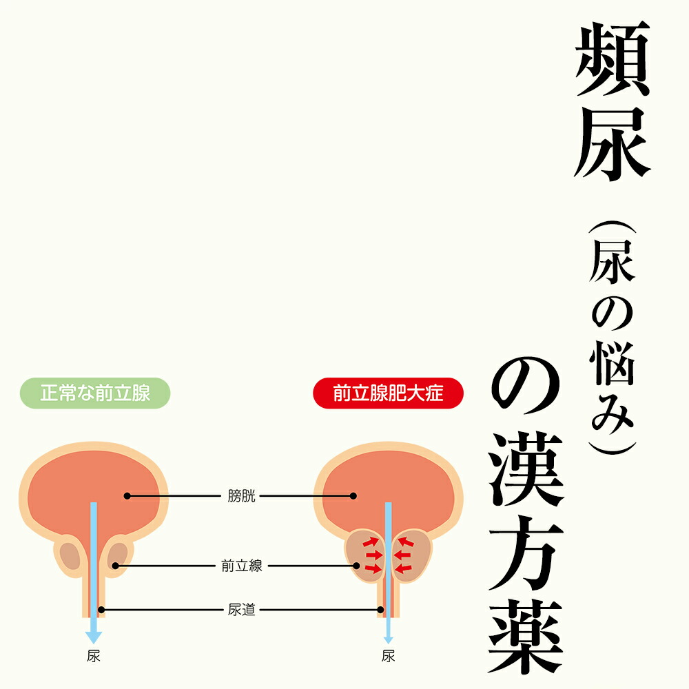 【第2類飲み薬】頻尿、前立腺肉付きのよいの漢方薬 1日2～4回取り入れる 30日分/90日分 漢方薬  頻尿、前立腺肉付きのよいの薬 前立腺炎の漢方 残尿感 立ち小便時の苦痛なこと 過活動写真膀胱などに漢方 八味地黄丸、牛車腎気丸、猪苓湯   貨物輸送無料 電話を掛ける無料話しあい・電子メイル話しあい24第四次元相応う
