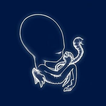 【中古】(未使用･未開封品)AGAETIS BYRJUN [2LP VINYL] [Analog] [LP Record] SIGUR ROS