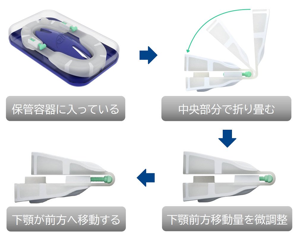 市場 レビュー書いて500円offクーポン 英国製 マウスピース スノアイーズ いびきグッズ Snoreeze 保管ケース付き