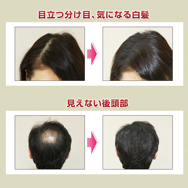 3本セット 薄毛スプレー 薄毛 白髪 生え際 自然にカバー お出かけ前5分で決まる シュットヘアスプレースタイリング フェイスガード ケープ付き 薄毛隠しスプレー お風呂サウナスーツ 増毛スプレー専用 お得価格 サウナスーツ 月曜から夜更かし紹介 プレゼント