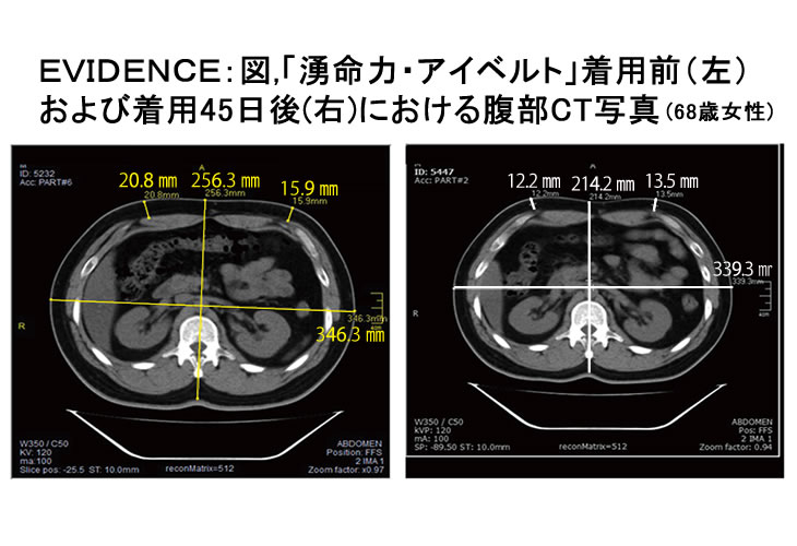 湧命力・アイベルト 健康グッズ | dermascope.com