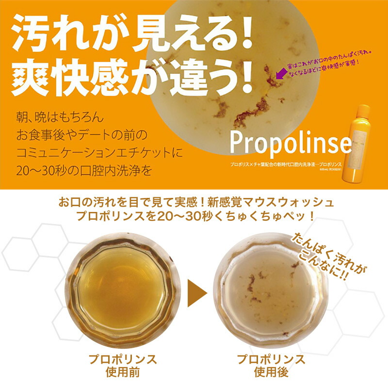 楽天市場 5本 プロポリンス ホワイトニング マウスウォッシュ 600ml 白 Propolinse ピエラス 口内洗浄液 プロポリス マウスウォッシュ 口臭予防 キシリトール配合 お買得 セット モニカモニカ 楽天市場店