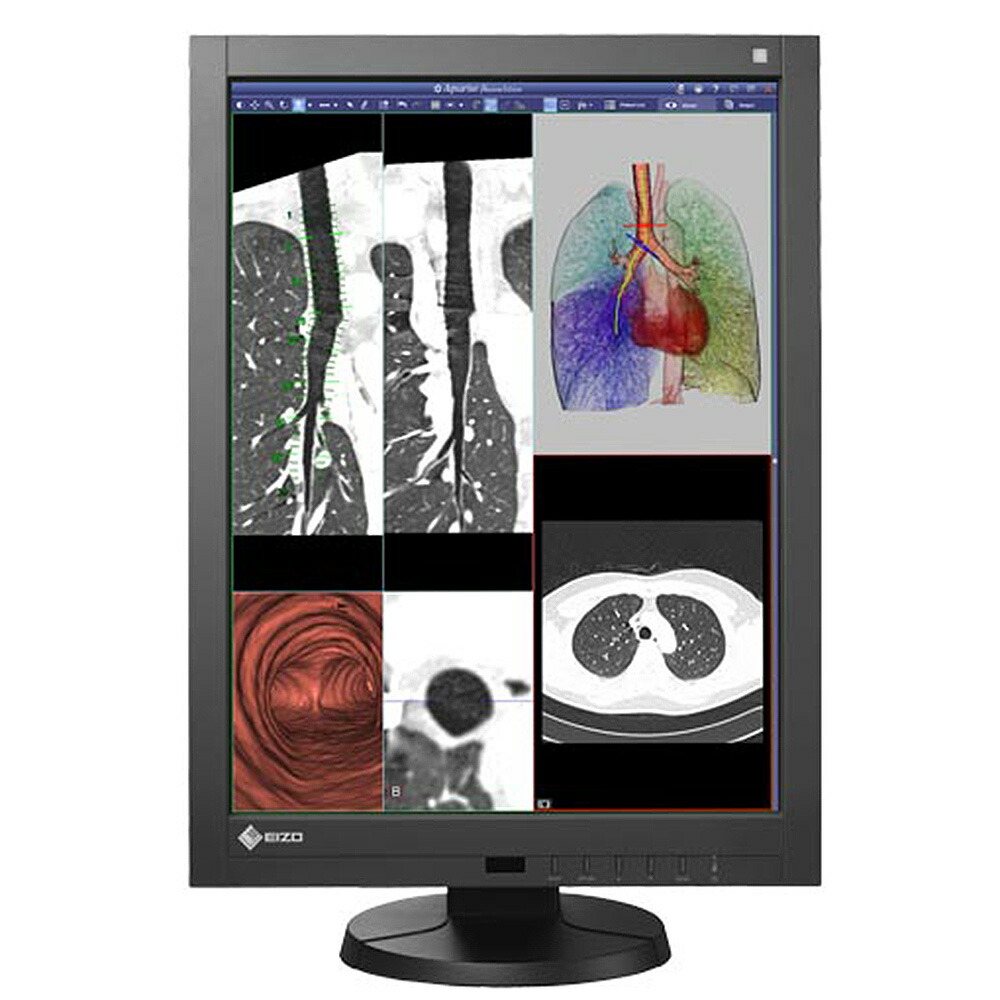 楽天市場】EIZO RadiForce GX340 医用 モノクロ液晶モニター IPS