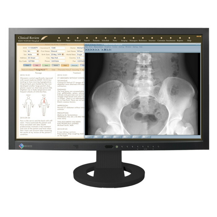 楽天市場】EIZO RadiForce GX340 医用 モノクロ液晶モニター IPS