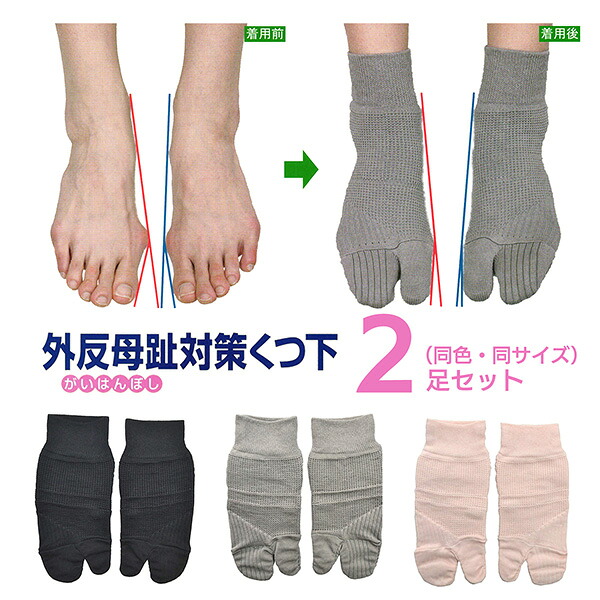 2足セット 外反母趾 対策 くつ下‐靴下 蘭華 コーポレーションパールスター 広島大学 外反母趾 予防 対策 矯正 パット 綿 就寝時 長時間着用