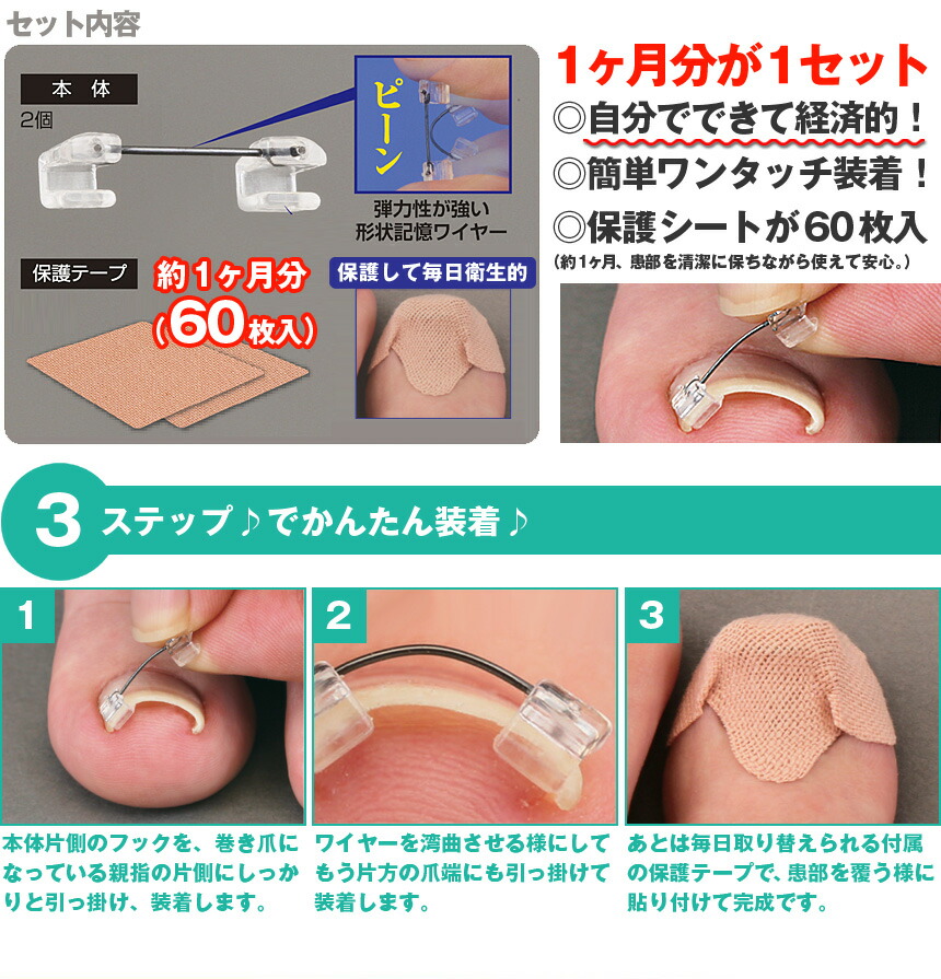 限定セール 巻き爪 巻き爪ワイヤーガード 巻き爪 まきつめ づめ まき 治療 ワイヤーガード シール サポーター 巻き爪 巻爪 シール 3ヶ月 巻きつめ 貼る 自宅 治療 簡単 改善 お悩み 足 ツメ 矯正 痛み 緩和 軽減 指先 500円offクーポン対象 送料無料 巻き爪 限定セール 巻き爪 巻き爪ワイヤーガード 巻き爪 まきつめ づめ まき 治療 ワイヤーガード シール サポーター 巻き爪 巻爪 シール 3ヶ月 巻きつめ 貼る 自宅 治療 簡単 改善 お悩み 足 ツメ 矯正 痛み 緩和 軽減 指先 500円offクーポン対象 送料無料 巻き爪