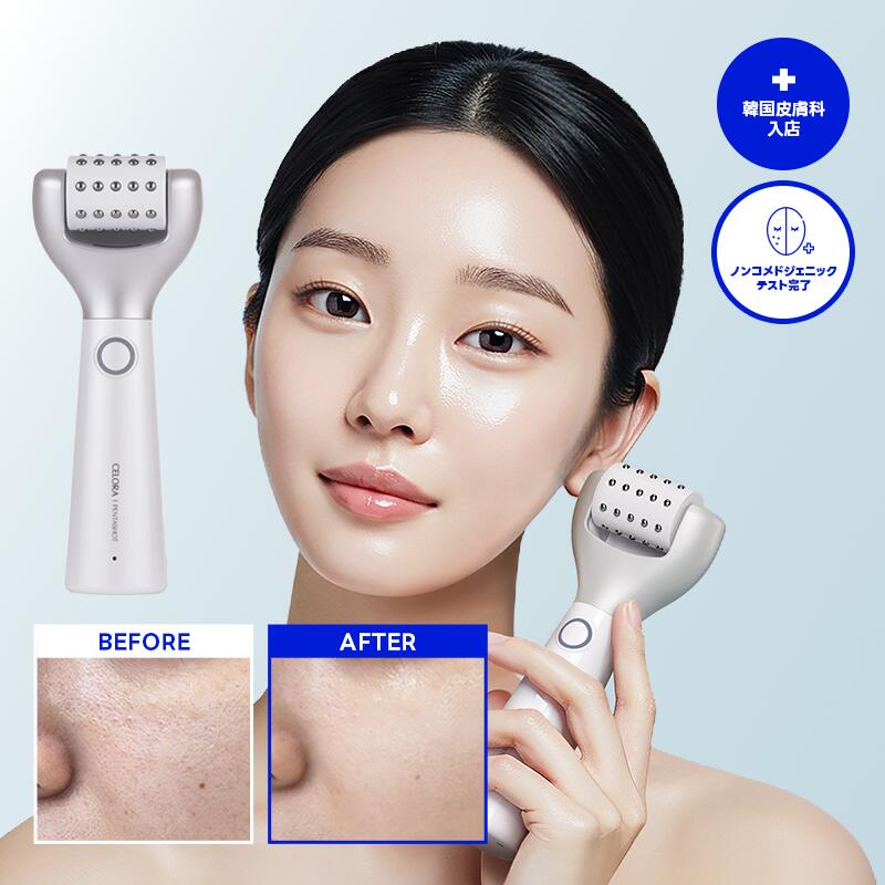 オゾン美顔器 imgrc0138624593.jpg