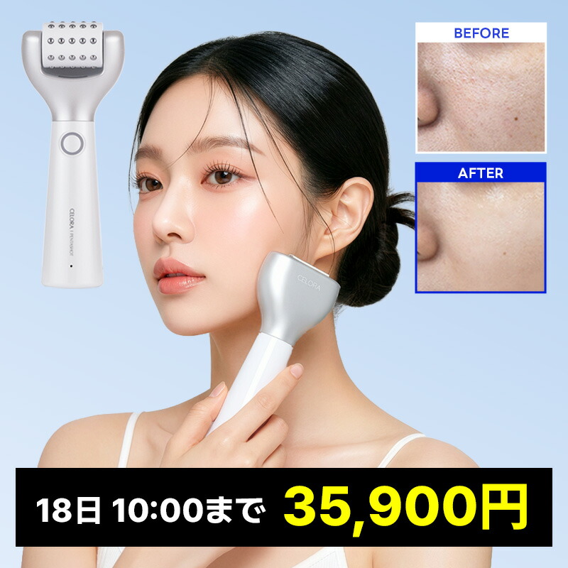 ペンタショット１日５分・細孔の目立ちにくい肌へ/高活動電位美顔器 肌柔軟性・色素落ち着いた・細孔・一片・ハリ・にきび跡  貨物輸送無料 ポテンションペンタショット スキンオープナー