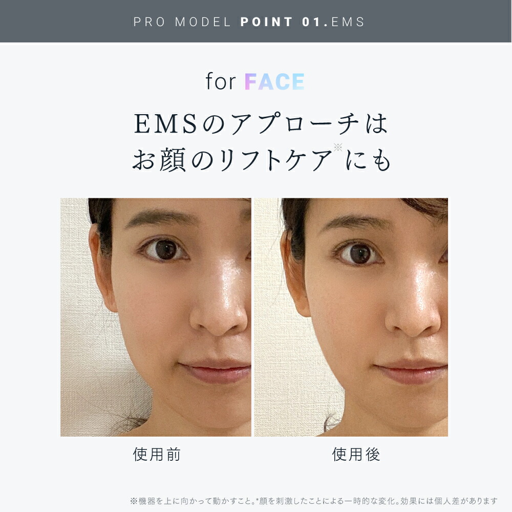 【公式｜10/1限定 10％OFFクーポン+ポイント10倍！】最高峰※ EMSヘッドスパ 頭皮 ヘッドマッサージ EMS 赤色LED 機能搭載【公式】 MYTREX EMS HEAD SPA PRO マイトレックス プロ フェイスケア リフトケア 頭皮ケア 電動頭皮ブラシ スカルプ スパ 美容