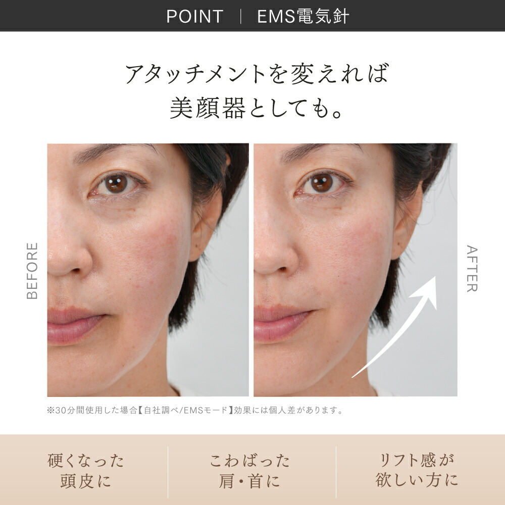 電気バリブラシとヘッドマッサージローション 2本組】デンキバリブラシローション セット | ELECTRON ONLINE SHOP