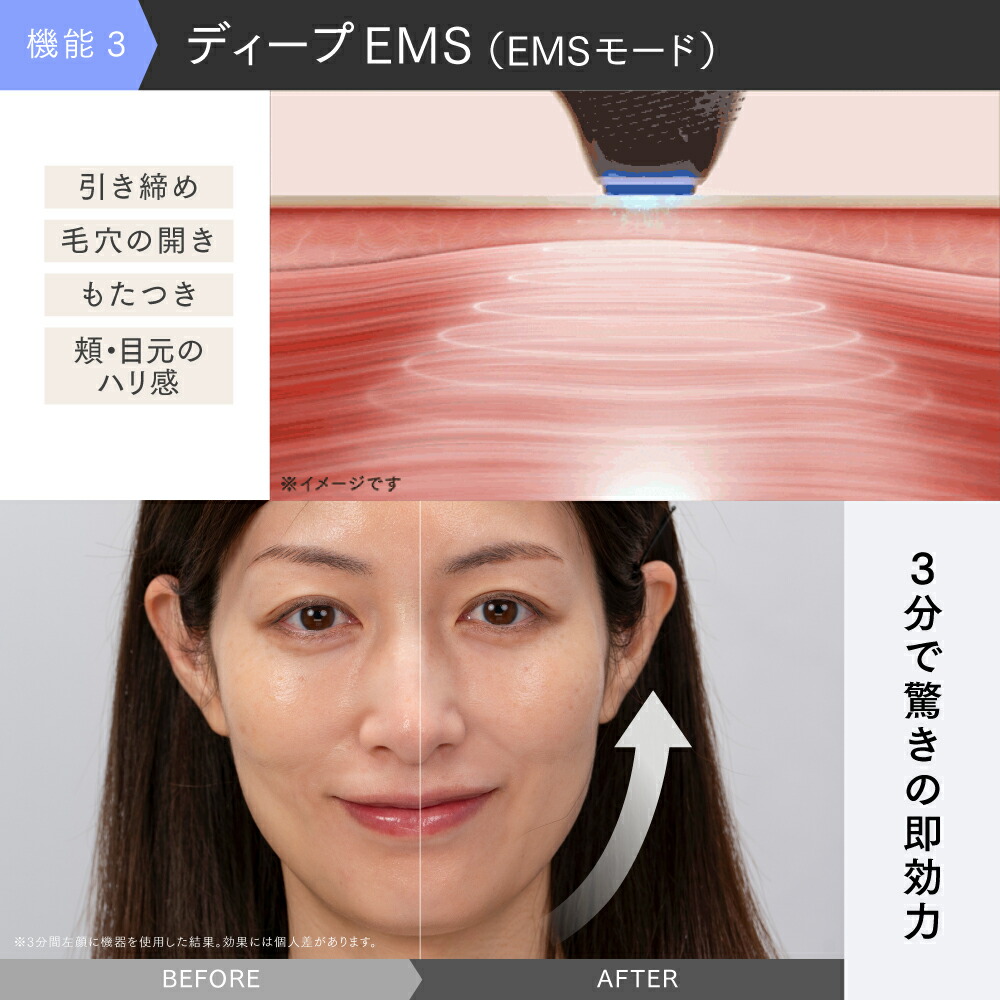 リン・チーリン愛用】美顔器 リフトアップ MYTREX MiRAY ONE ホワイト