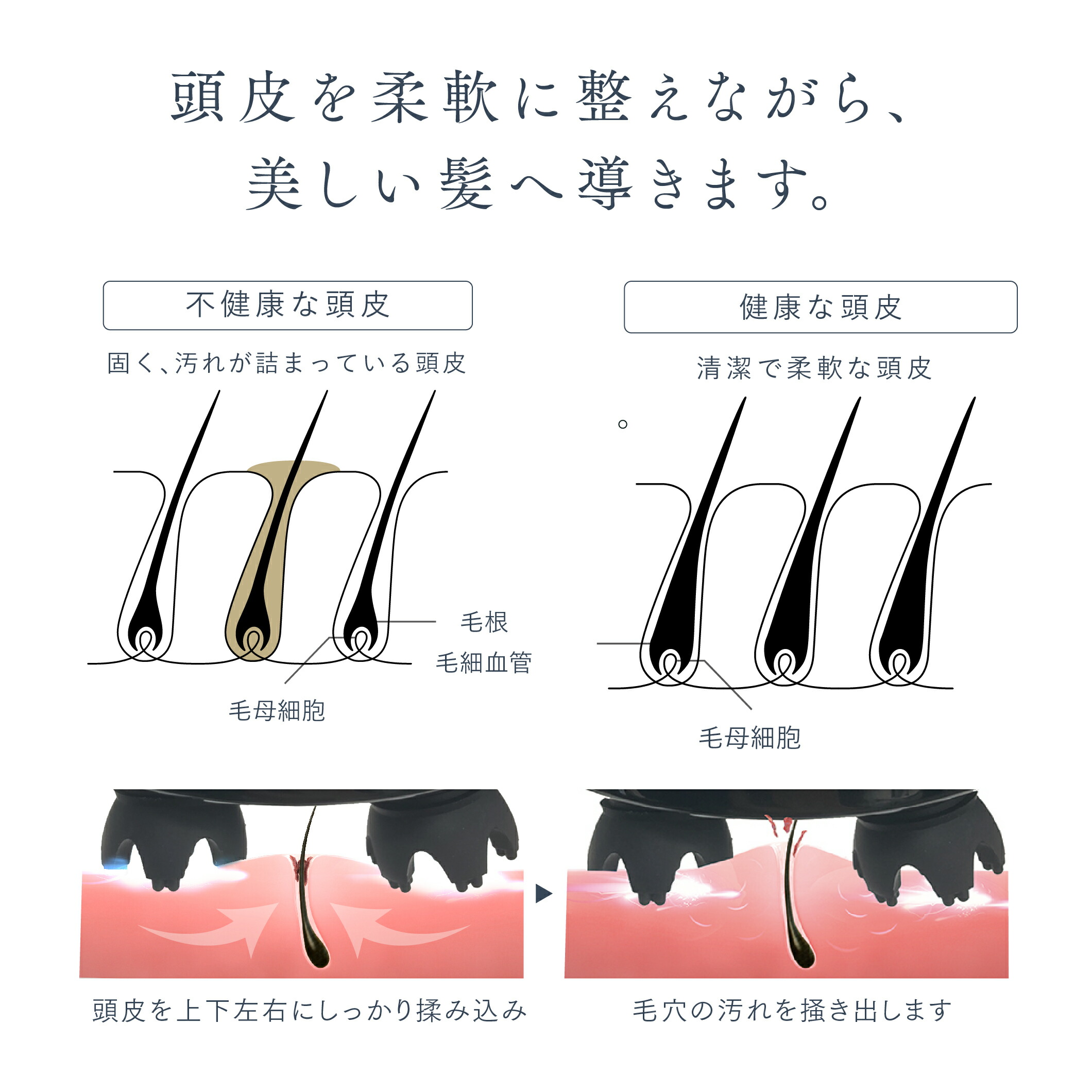頭皮ケア,頭皮ケアブラシ,頭皮ケアヘッドスパ,頭皮ケア,EMSHEADSPA,MYTREX,HEAD,SPA,マイトレックス,ヘッドスパ,ヘッド,スパ,頭皮ケア,頭皮,ケア,頭,防水,自動,充電,コードレス,充電式,薄毛,抜け毛,リラックス,皮脂汚れ,皮脂,頭皮,柔軟,汚れ,防止,地肌スッキリ