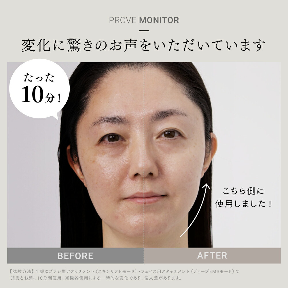 新年特別企画！30％OFFクーポン＋特典付き！】EMS 美顔器 リフトアップ