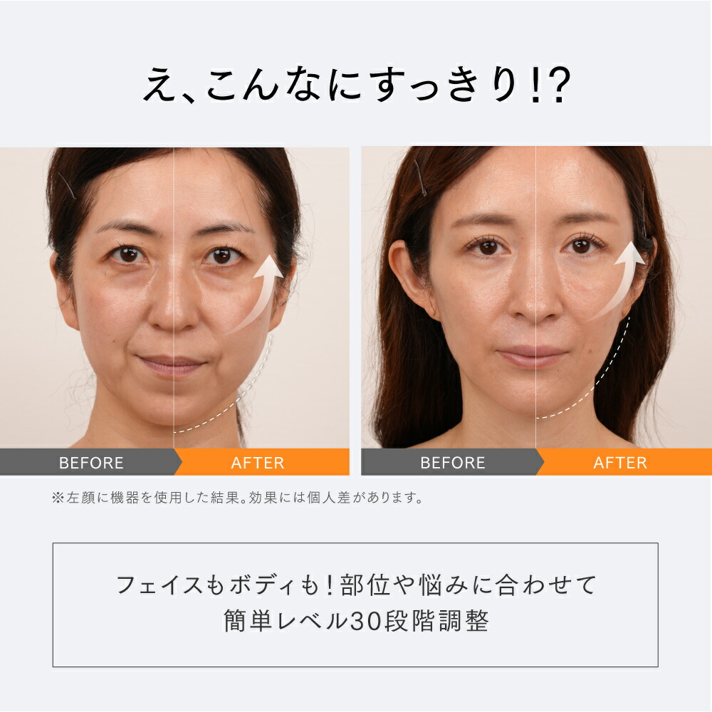 公式｜期間限定 5%OFFクーポン+P5倍！】フェイスポイントガン ポスポス