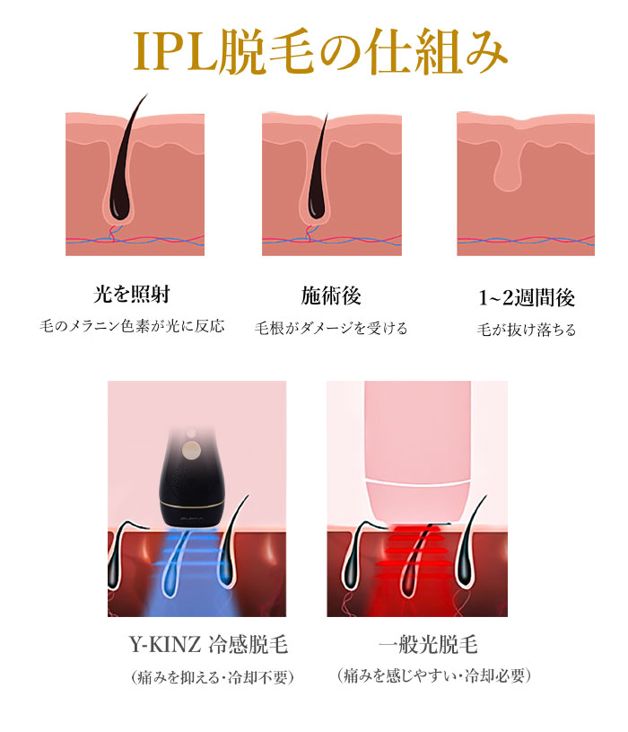 Y Kinz 脱毛器 光脱毛器 光美容器 光エステ フラッシュ式 Ipl光脱毛器 家庭用 冷感脱毛 Vio対応 99万回照射 レディース メンズ 顔 ボディ ビキニライン 全身用 自動照射 レザー ムダ毛ケア クーリング機能 男女兼用 家庭用脱毛器 Butlerchimneys Com
