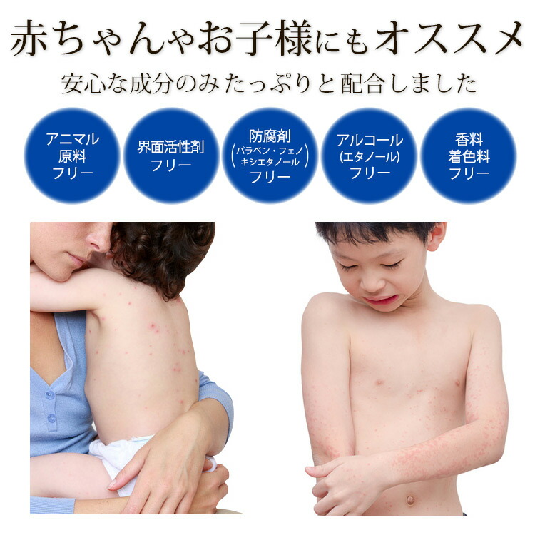 乾燥肌対策 フコイダン保湿ローション 200ml トラブル肌 敏感肌 子ども 花粉 頭皮 カサカサ ムズムズ 肌荒れ 化粧水 アットピースラボ 無添加 バリア スキンケアローション ラムズ マークス