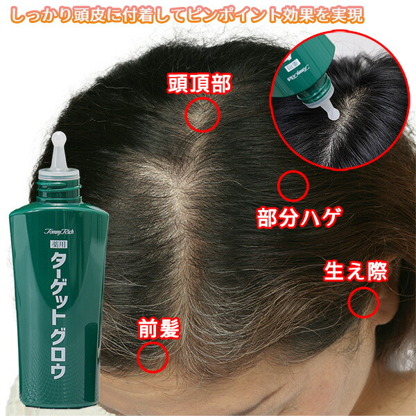 2本セット トミーリッチ 薬用ターゲットグロウ 100ml 2本 医薬部外品 薬用 育毛剤 薄毛 抜け毛 ボリューム 頭頂部 生え際 部分ハゲ 前髪 センブリエキス メンズ レディース 40代 50代 60代 70代 敬老の日 父の日 母の日 ギフト プレゼント 送料無料 沖縄 離島除く Umu Ac Ug