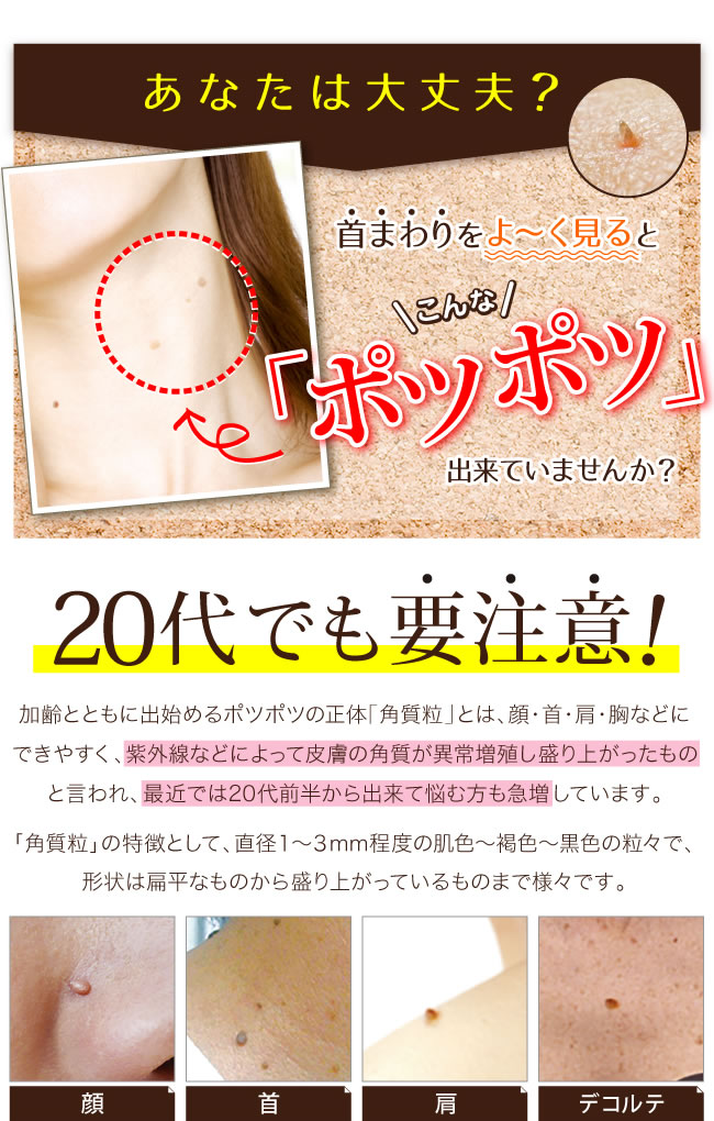 スコア10倍増し イポケアーex 10ヴォリュームひとそろい イボ取り イボ取りアイスクリーム お人はだ ポツポツ 取りやめる 角質ケア美容リクイッド 赤銅 イボケア 角質玉 平滑肌 ヨクイニン 角質取り 疣疣 取りくずす イボ 角質 喉頸 真皮 逸脱 顏 年取る イボ取りクリーム