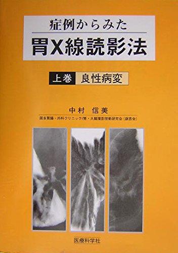 【中古】症例からみた胃X線読影法〈上巻〉良性病変
