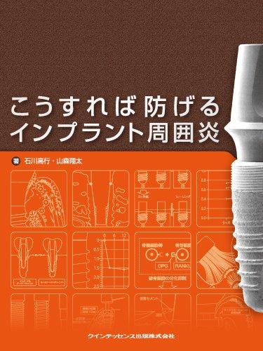 【中古】こうすれば防げるはたご屋工業プラント境界線の外側炎