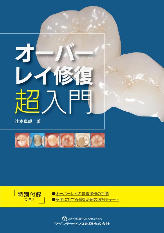 【中古】オーバーレイ修復 超入門|LINEAR shop
