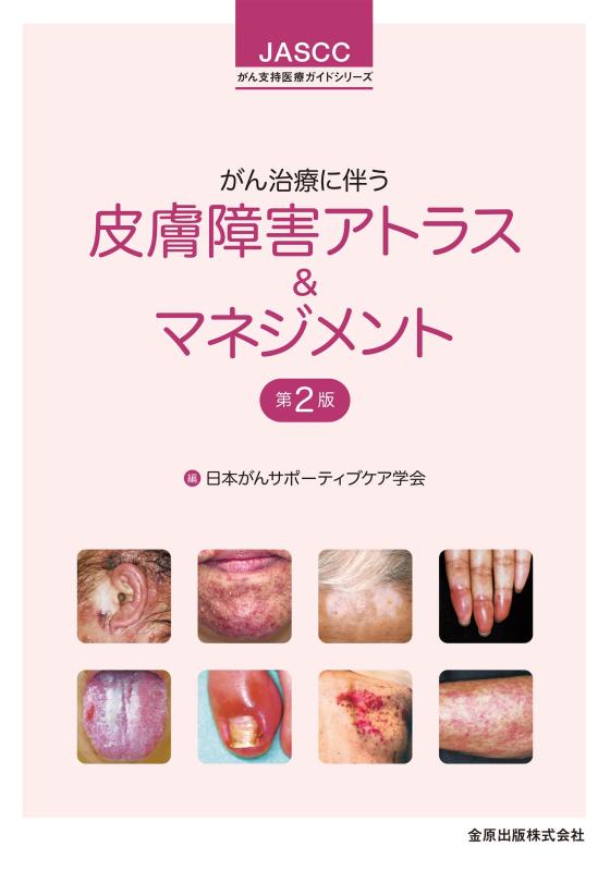 【中古】癌腫和らげるに伴う人はだ手足まといアトラス\u0026amp;管理すること 第2版 (JASCC癌腫うしろ押し診療御引き回し続きもの)
