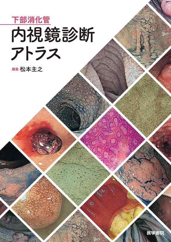 【中古】下部消化管内視鏡診断アトラス｜LINEAR shop