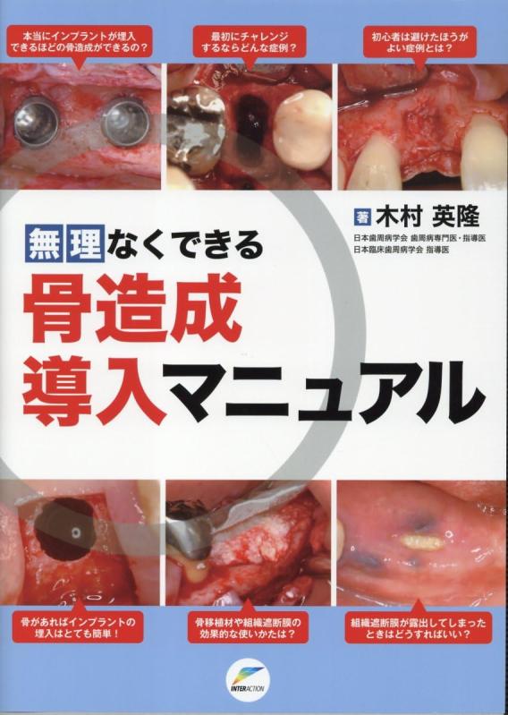 【中古】無理なくできる骨造成導入マニュアル|LINEAR shop