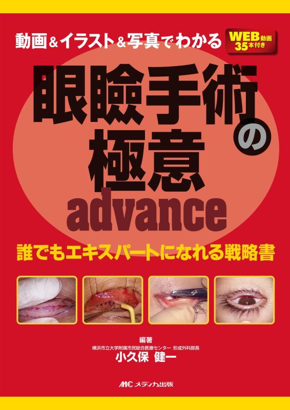 【中古】映像＆さし絵＆活動写真でわかる目蓋外科手術の極意 advance：誰でも老練家になれる試合ぶり書
