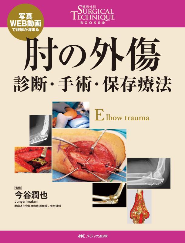 【中古】肘の外傷:診断・手術・保存療法 (整形外科SURGICAL TECHNIQUE BOOKS 11)｜LINEAR shop