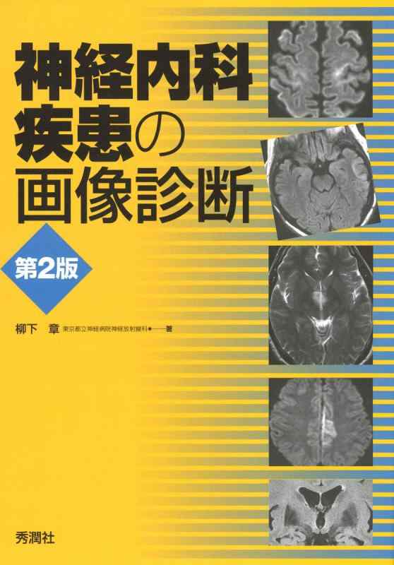 【中古】神経内科疾患の画像診断 第2版|LINEAR shop