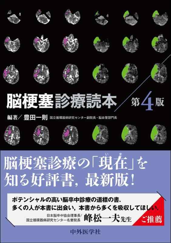 【中古】脳梗塞見たて読み手 第4版 日用品雑貨・文房具・手芸-その他