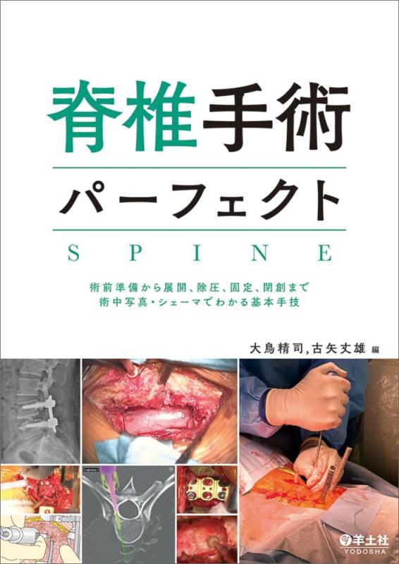 【中古】脊椎手術パーフェクト~術前準備から展開、除圧、固定、閉創まで術中写真・シェーマでわかる基本?技|LINEAR shop