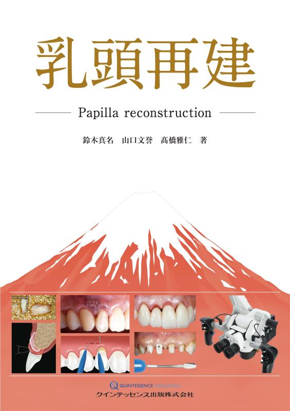 【中古】乳頭再建: Papilla reconstruction｜LINEAR shop