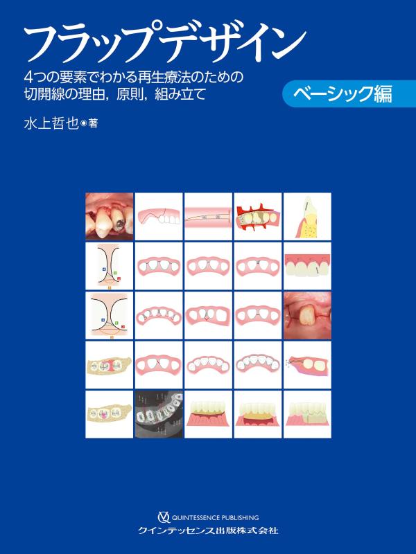 【中古】フラップデザイン ベーシック編: 4つの要素でわかる再生療法のための切開線の理由,原則,組み立て|LINEAR shop