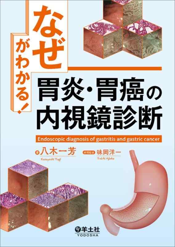 【中古】「なぜ」がわかる胃炎・胃癌の内視鏡読み合わせる