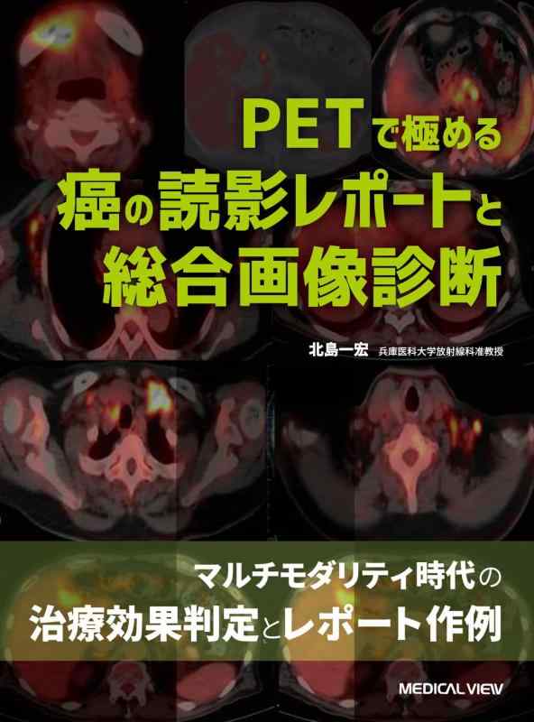 【中古】PETで極める癌の読影レポートと総合画像診断|LINEAR shop