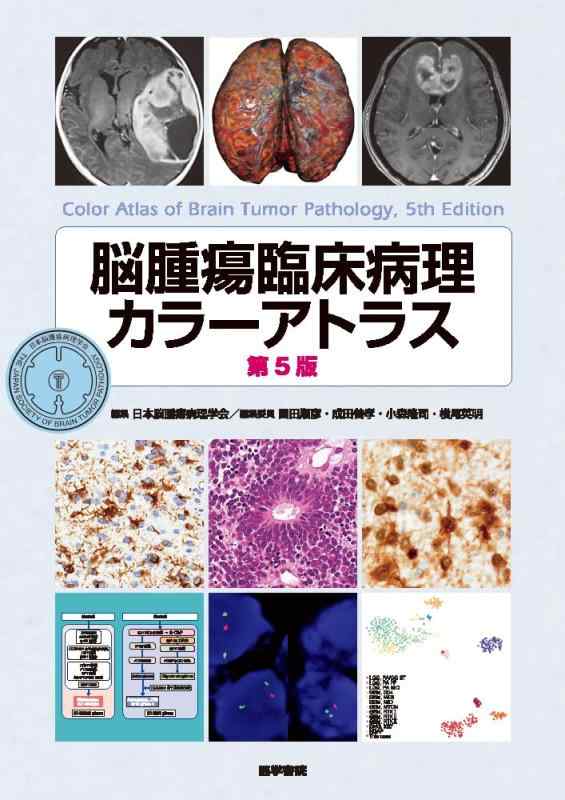【中古】脳腫瘍臨床病理学色合いアトラス 第5版