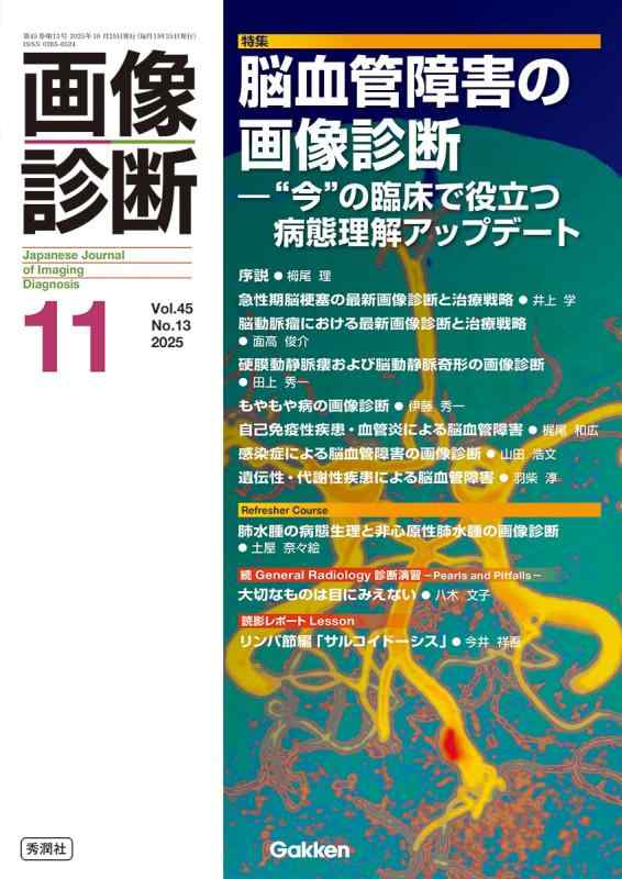 【中古】画像診断2025年11月号 Vol.45 No.13: 脳血管障害の画像診断 —”今”の臨床で役立つ病態理解アップデート|LINEAR shop
