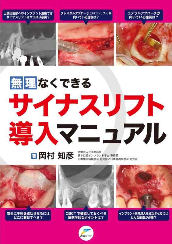 【中古】無理なくできるサイナスリフト導入マニュアル|LINEAR shop