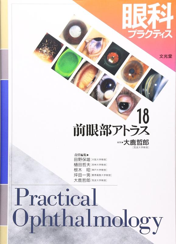 【中古】眼科プラクティス (18) 前眼部アトラス|LINEAR shop