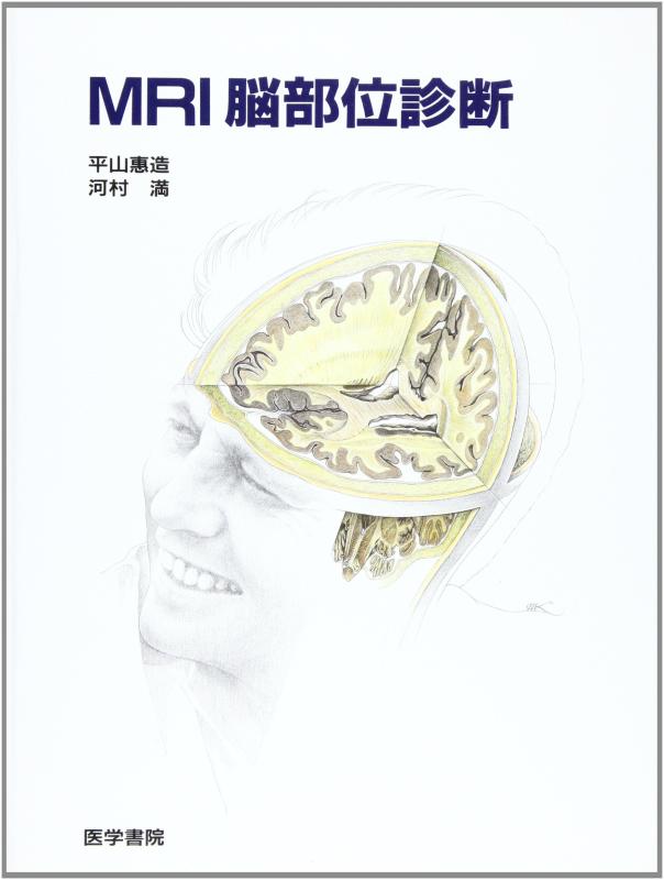 【中古】MRI脳部位診断｜LINEAR shop