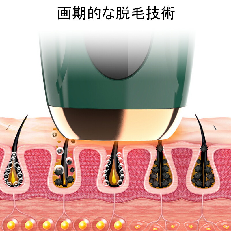 市場 最新ドイツ製レーザー使用 シリーズ サロン級脱毛器 100万発 大人気 男女兼用 家庭用脱毛器 オリジナルモデル 全身適用 脱毛器 IPL光