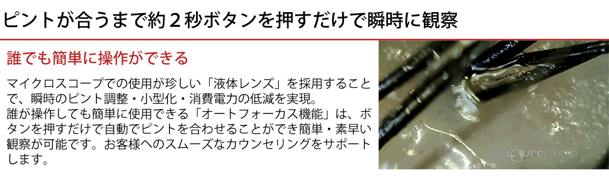 顕微銀鏡 血流領域 頭皮 素膚 マイクロスコープ 頭皮血流差し押さえ利運 オート中心viewty 一杯飲屋 美容 血流監督 検定 最大250二倍 数倍率 チェック 確証 Acilemat Com