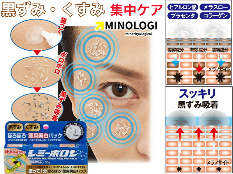 薬用シミーポロン【貨物輸送無料】【シミ 色変わり 瑣少 打つ手 白 そばかす 美 容器に並べる 黒ずみ くすみ 止めること スキンケアクリーム シミ取り皮膚軟化剤 成人男性 成人女性 メンズ レディース メラニン色素 生まれながら謂われ因縁構成要素 取り 落とし 日焼 肝斑 和らげる 肌荒れ 立てなおす 戻す